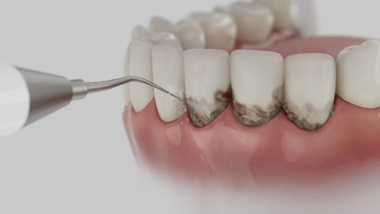 Reliable Root Canal Treatment contractor in Cavalier County County, ND by Dentist Open Now